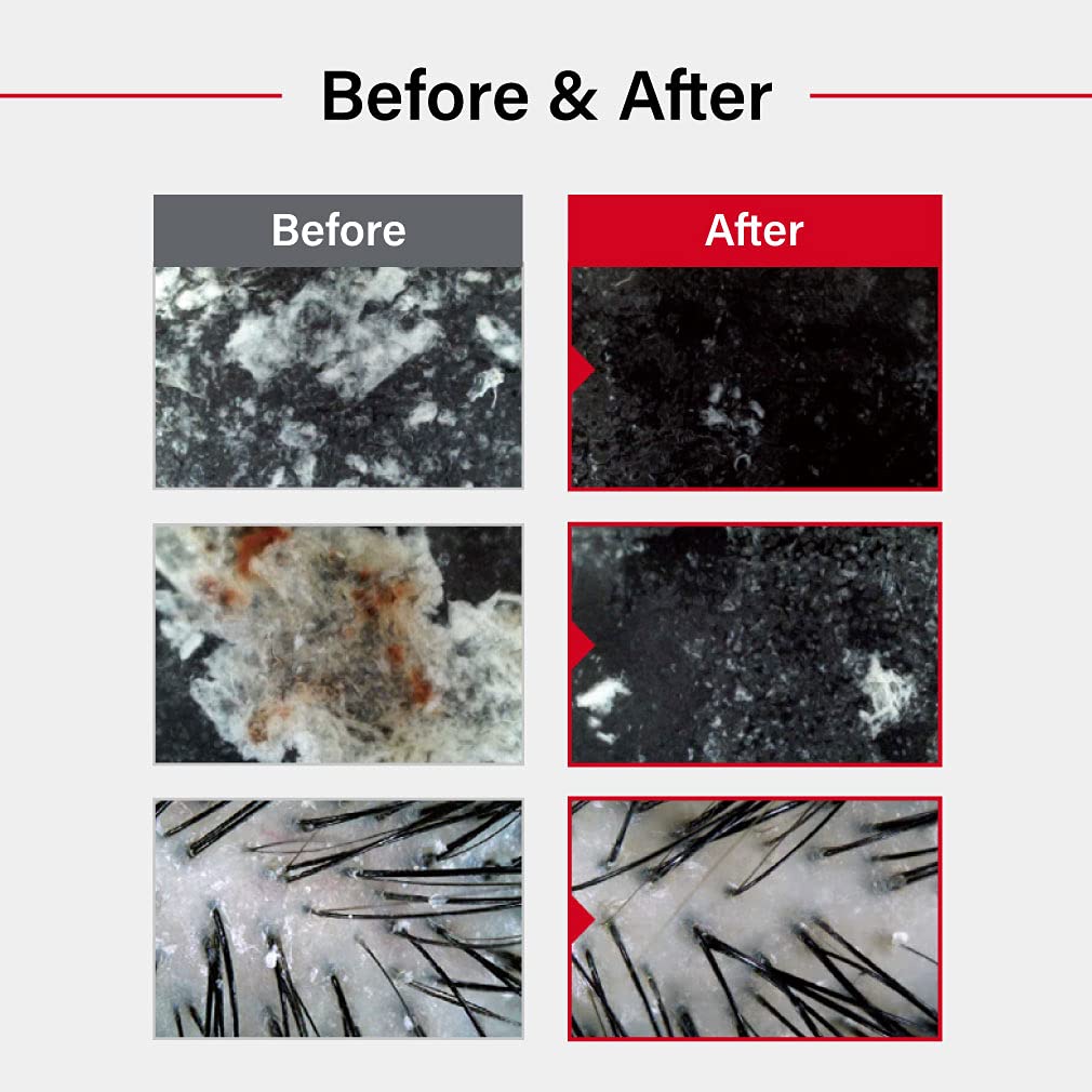 Dr.FORHAIR Folligen Sea Salt Scaler | Korean Hair Care | Scalp Exfoliator & Scalp Scrub | Eliminates Sebum, Impurities, Odor | Nourish and Freshen, 10.58 fl oz