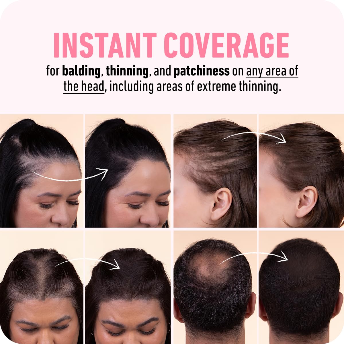 BOLDIFY Hairline Powder (LARGE, 10g) - Root Touch Up Hair Color for Gray Coverage - Bald Spot Concealing Hair Powder for Women & Men - 48-Hour Stain-Proof - Dark Auburn