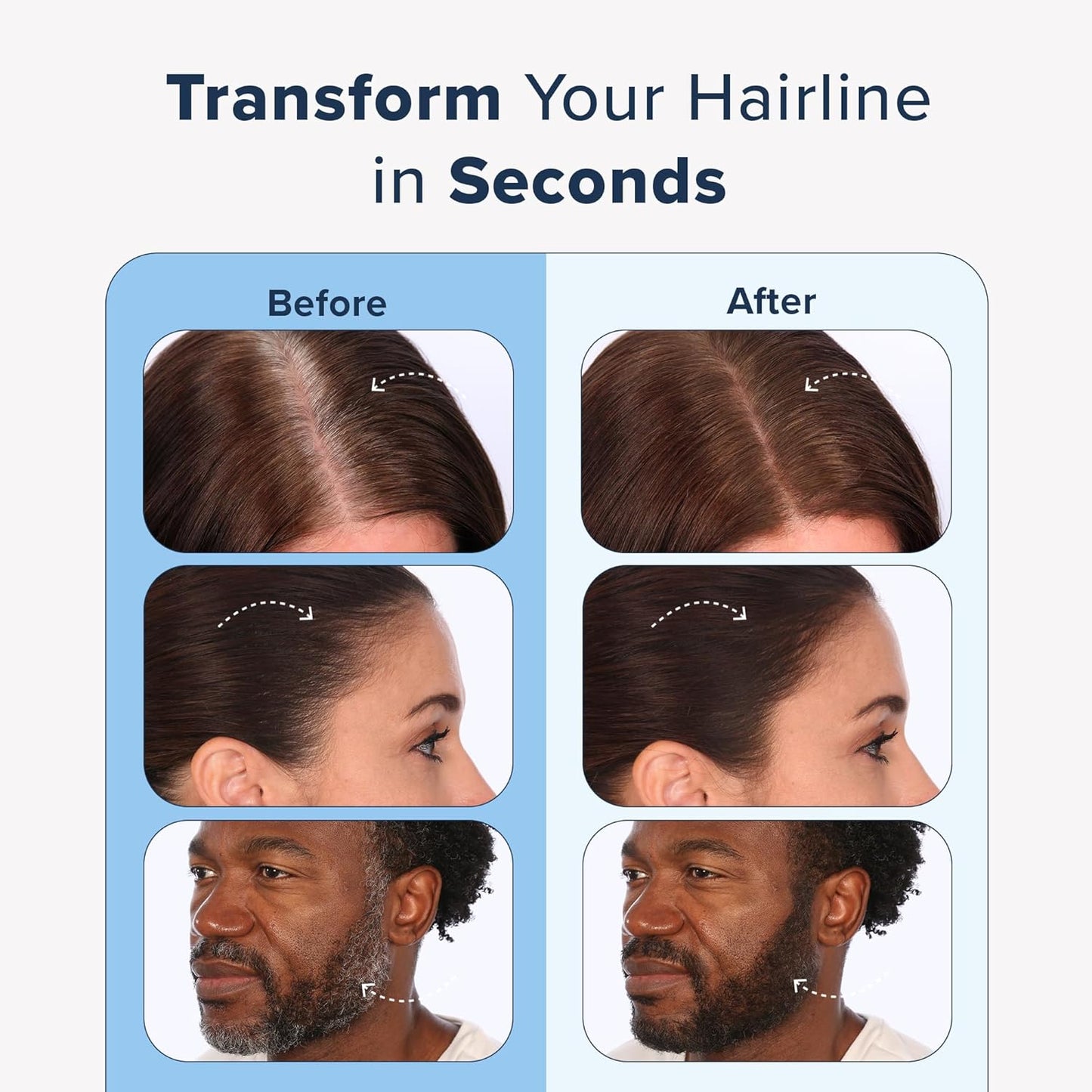 TRUHAIR Color & Conceal Waterproof Root Touch Up Hair Color Concealer - Hair Cover up for Gray Coverage and Hairline Filling - 11 Hair Colors Available (Black)