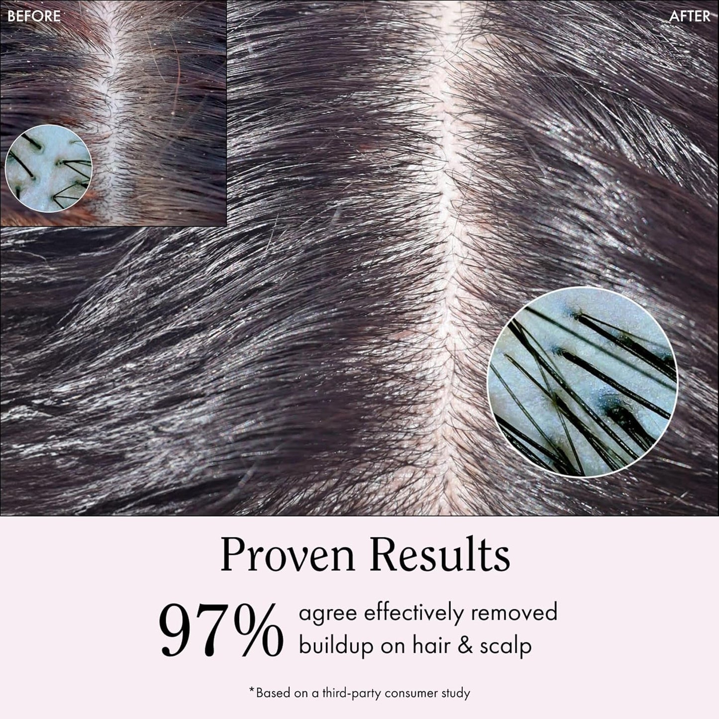 Rizos Curls Travel Apple Cider Vinegar Scalp & Hair Rinse, Clarifies to Remove Product Buildup, Balance Oils, Revive Hair & Scalp, Enhances Softness & Shine, 2.5 oz